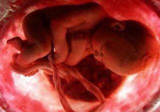  چند فاكتور خطرساز در معرض خطر سقط جنين قرار گرفتن