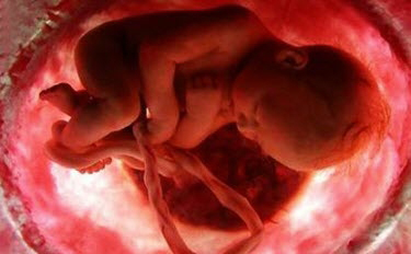 چند فاكتور خطرساز در معرض خطر سقط جنين قرار گرفتن